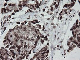 CHN1 Antibody in Immunohistochemistry (Paraffin) (IHC (P))