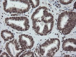 CHN1 Antibody in Immunohistochemistry (Paraffin) (IHC (P))