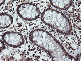 CHN1 Antibody in Immunohistochemistry (Paraffin) (IHC (P))