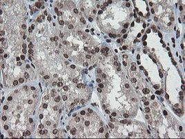 CHN1 Antibody in Immunohistochemistry (Paraffin) (IHC (P))