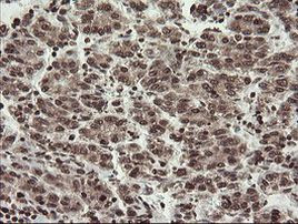 CHN1 Antibody in Immunohistochemistry (Paraffin) (IHC (P))