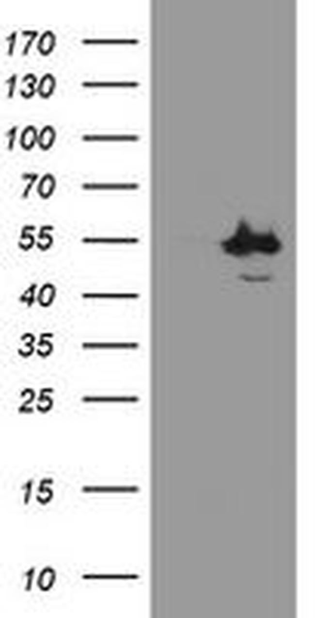 CHN1 Antibody in Western Blot (WB)