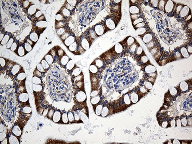 CHP1 Antibody in Immunohistochemistry (Paraffin) (IHC (P))