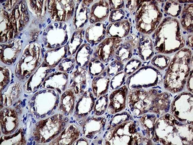 CHP1 Antibody in Immunohistochemistry (Paraffin) (IHC (P))