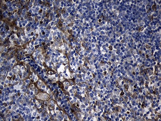 CHP1 Antibody in Immunohistochemistry (Paraffin) (IHC (P))