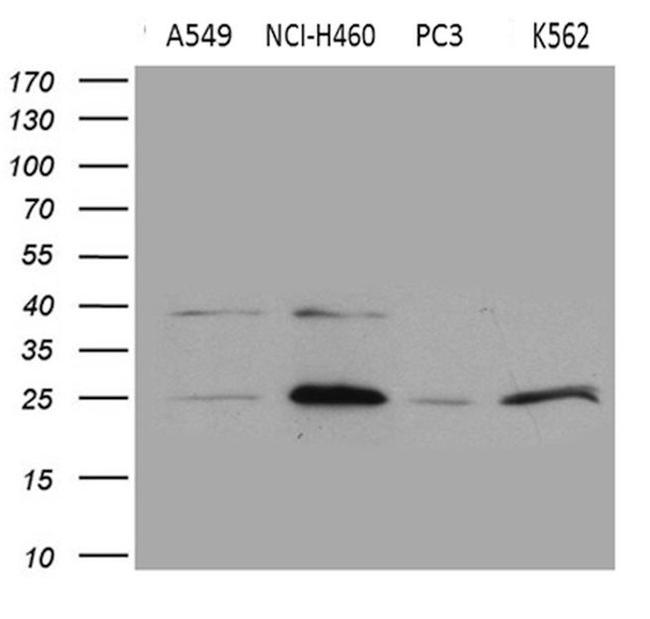 CHP1 Antibody in Western Blot (WB)