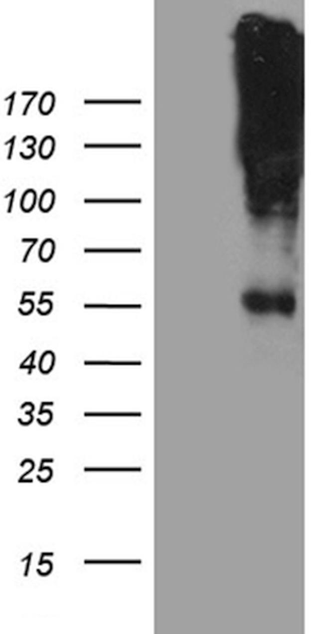 CHRNA5 Antibody in Western Blot (WB)