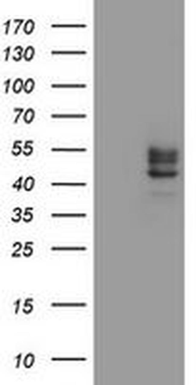 CHST6 Antibody in Western Blot (WB)