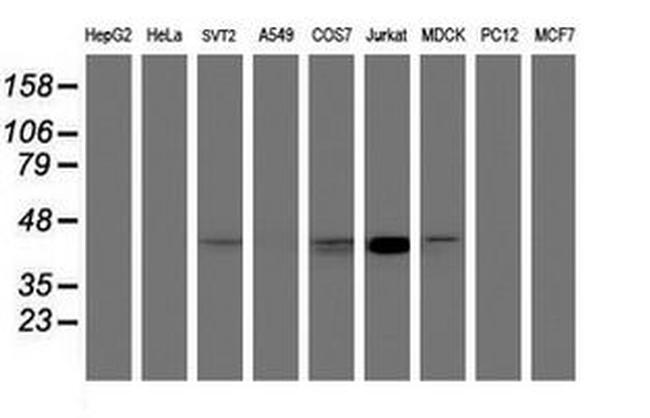 CHST6 Antibody in Western Blot (WB)