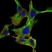 IKK alpha Antibody in Immunocytochemistry (ICC/IF)