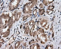 CISD1 Antibody in Immunohistochemistry (Paraffin) (IHC (P))