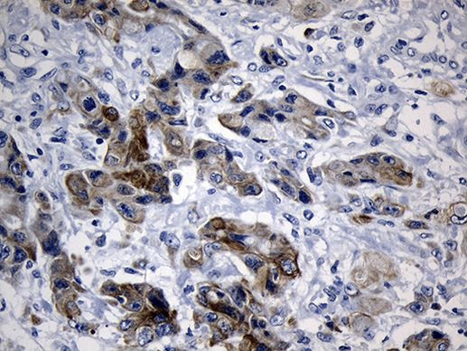 CISD2 Antibody in Immunohistochemistry (Paraffin) (IHC (P))