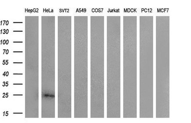 CITED1 Antibody in Western Blot (WB)