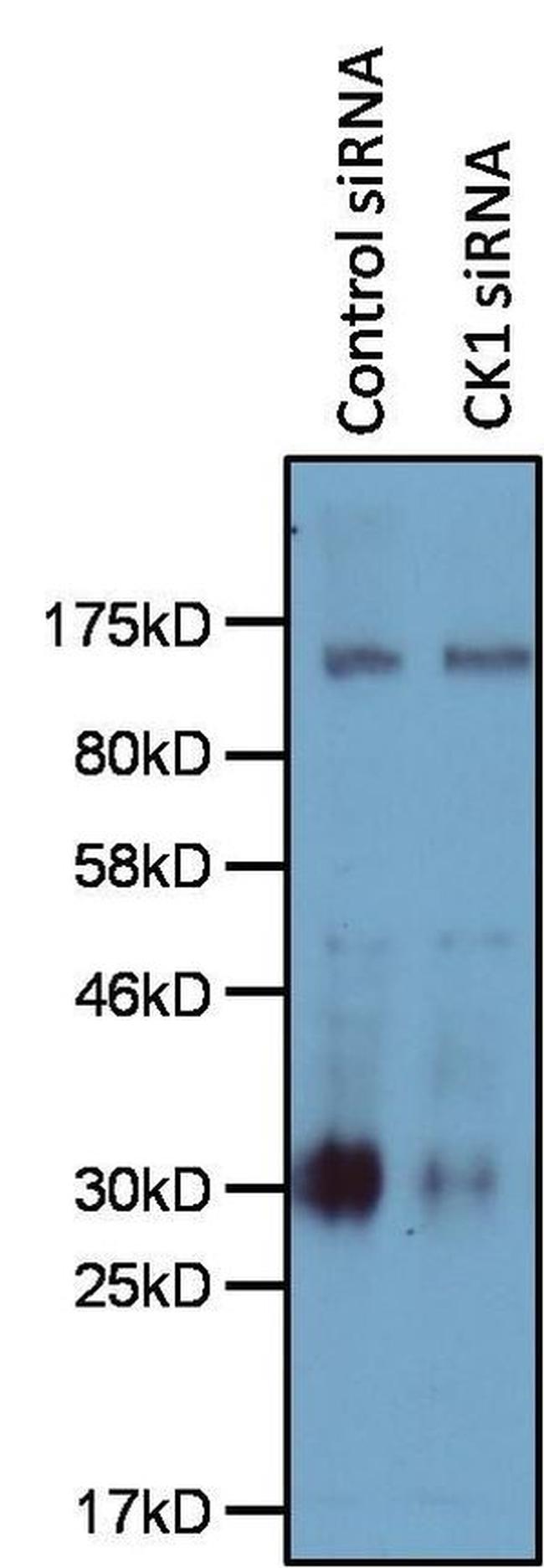 CK1 alpha Antibody in Western Blot (WB)