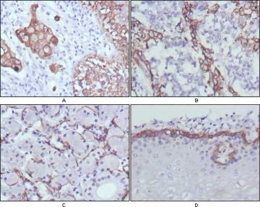 Cytokeratin 17 Antibody in Immunohistochemistry (Paraffin) (IHC (P))