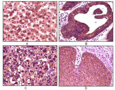 CK1 alpha Antibody in Immunohistochemistry (Paraffin) (IHC (P))