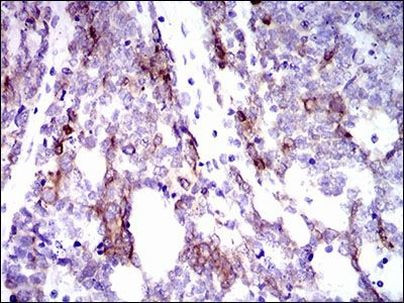 Cytokeratin 5 Antibody in Immunohistochemistry (Paraffin) (IHC (P))