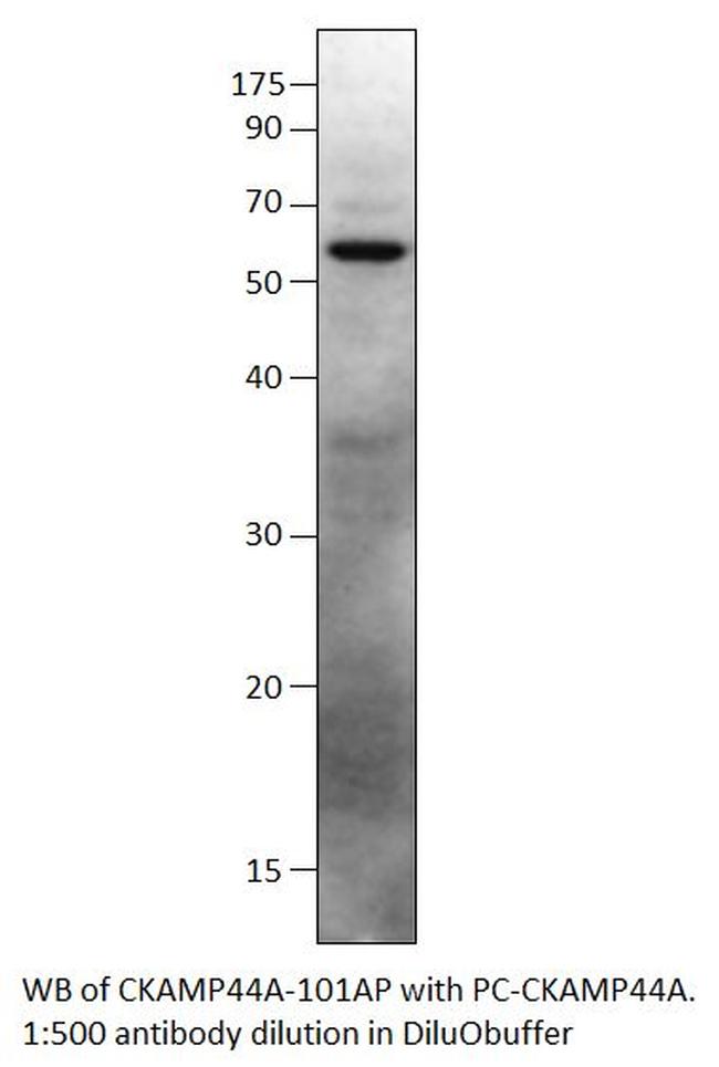 SHISA9 Antibody in Western Blot (WB)