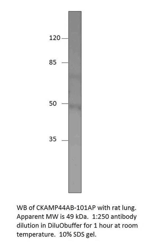 SHISA9 isoform X2 Antibody in Western Blot (WB)