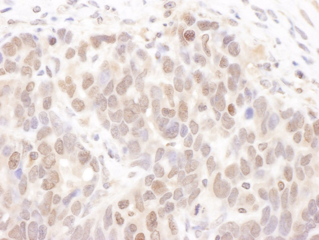 CKII alpha Antibody in Immunohistochemistry (IHC)