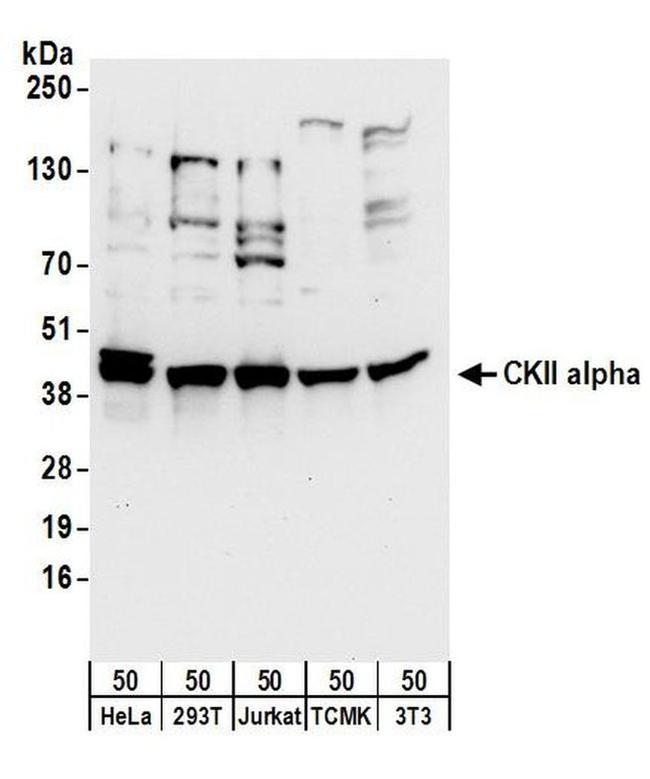 CKII alpha Antibody in Western Blot (WB)