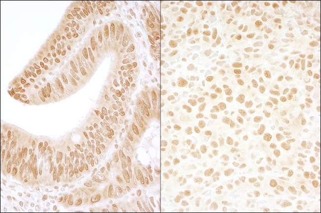 CKII beta Antibody in Immunohistochemistry (IHC)