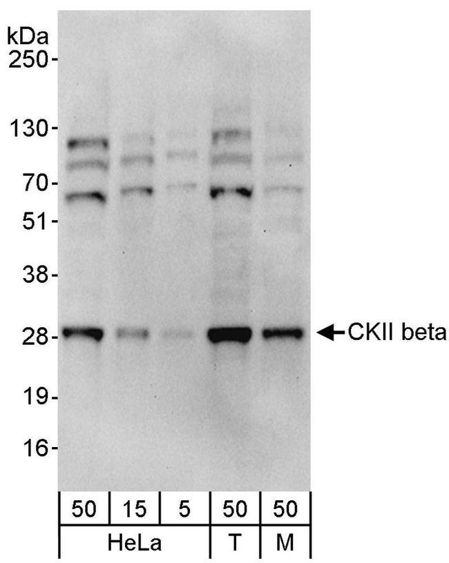 CKII beta Antibody in Western Blot (WB)