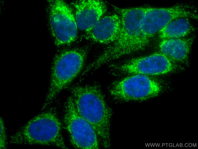 FIS1 Antibody in Immunocytochemistry (ICC/IF)