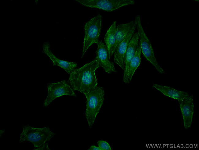 Septin 2 Antibody in Immunocytochemistry (ICC/IF)