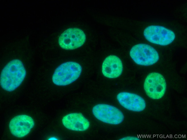 FUS/TLS Antibody in Immunocytochemistry (ICC/IF)