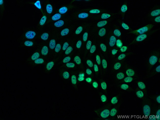 FUS/TLS Antibody in Immunocytochemistry (ICC/IF)