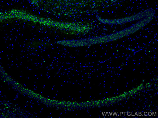 Sortilin Antibody in Immunohistochemistry (PFA fixed) (IHC (PFA))