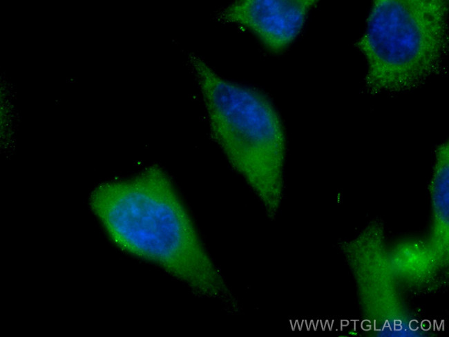 PPP3CA Antibody in Immunocytochemistry (ICC/IF)