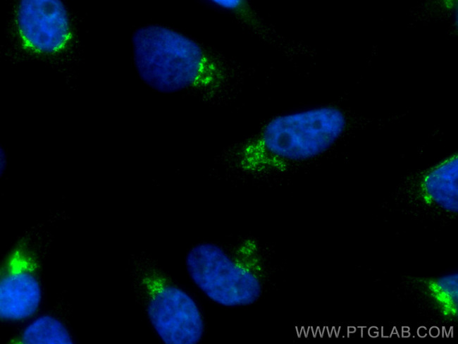 TGN46 Antibody in Immunocytochemistry (ICC/IF)