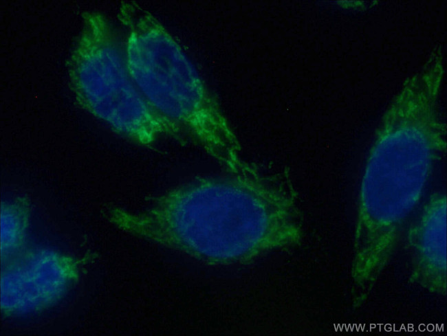 MAVS-VISA Antibody in Immunocytochemistry (ICC/IF)