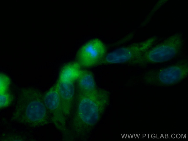 CEP63 Antibody in Immunocytochemistry (ICC/IF)