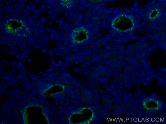 ZP3 Antibody in Immunohistochemistry (PFA fixed) (IHC (PFA))