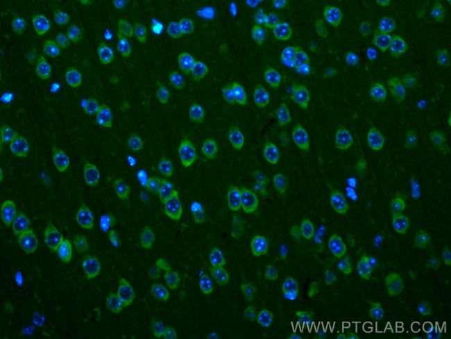 Ataxin 2 Antibody in Immunohistochemistry (PFA fixed) (IHC (PFA))