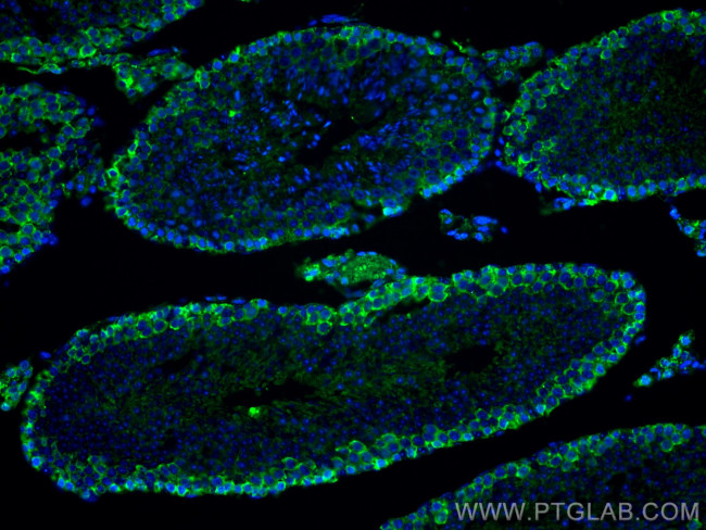 C9orf72 Antibody in Immunohistochemistry (PFA fixed) (IHC (PFA))