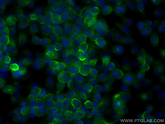 ANK3 Antibody in Immunocytochemistry (ICC/IF)