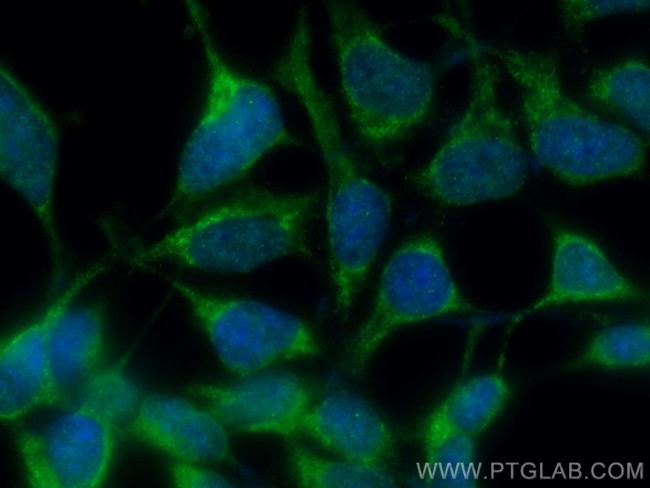 USP9X Antibody in Immunocytochemistry (ICC/IF)