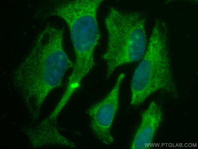 KEAP1 Antibody in Immunocytochemistry (ICC/IF)