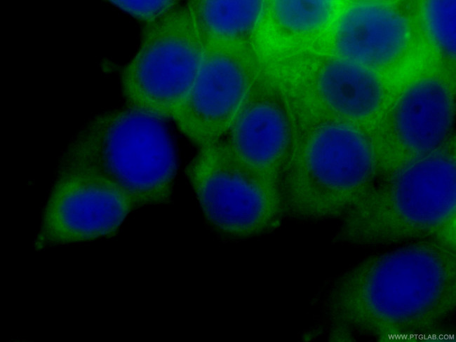 Annexin A2 Antibody in Immunocytochemistry (ICC/IF)