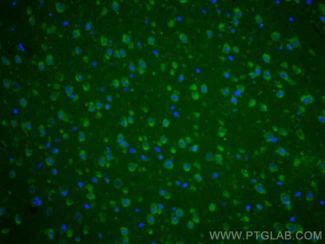 Syntaxin 6 Antibody in Immunohistochemistry (PFA fixed) (IHC (PFA))