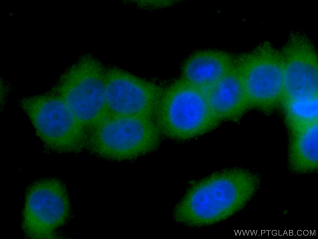 Follistatin Antibody in Immunocytochemistry (ICC/IF)