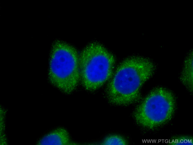 Stanniocalcin 2 Antibody in Immunocytochemistry (ICC/IF)