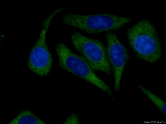 RRM1 Antibody in Immunocytochemistry (ICC/IF)