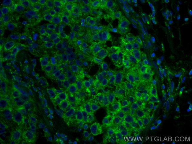 RRM1 Antibody in Immunohistochemistry (PFA fixed) (IHC (PFA))