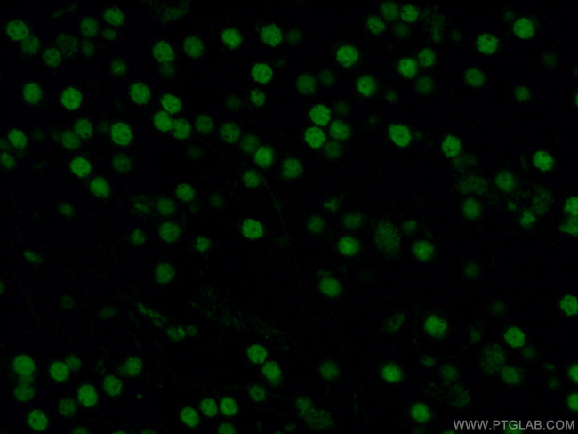 DACH1 Antibody in Immunohistochemistry (PFA fixed) (IHC (PFA))