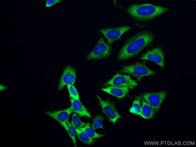 EEF1D Antibody in Immunocytochemistry (ICC/IF)